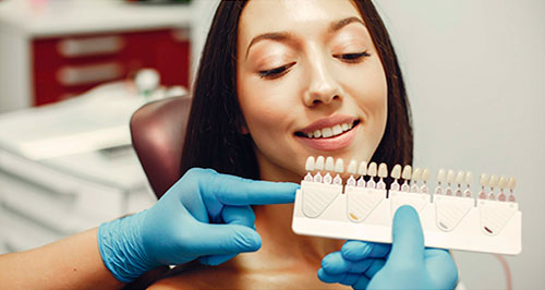 carillas-cph-1 estetica dental